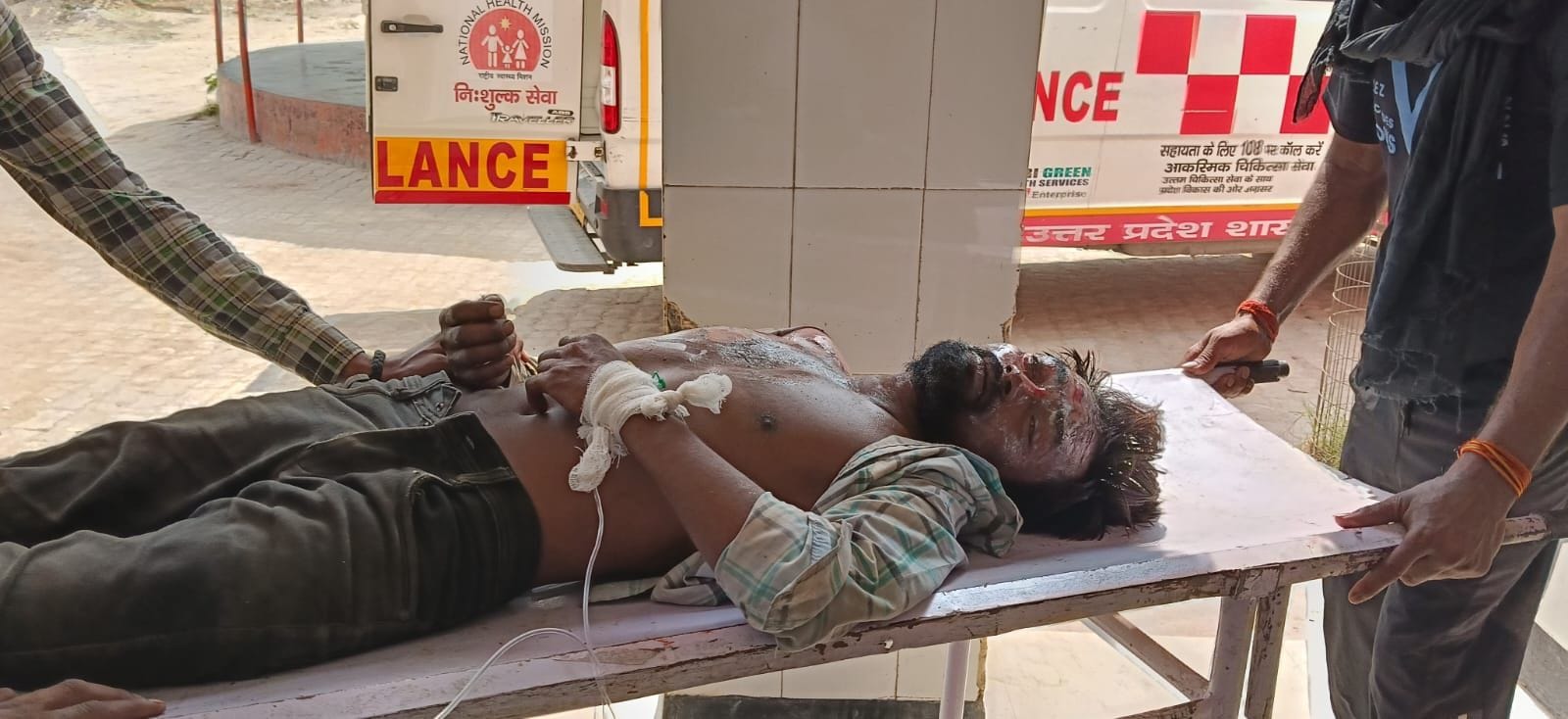 लालगंज कोतवाली क्षेत्र के नरसिंहपुर मटेहना गांव में बिजली लाइन की चपेट में आने से झुलसा युवक।