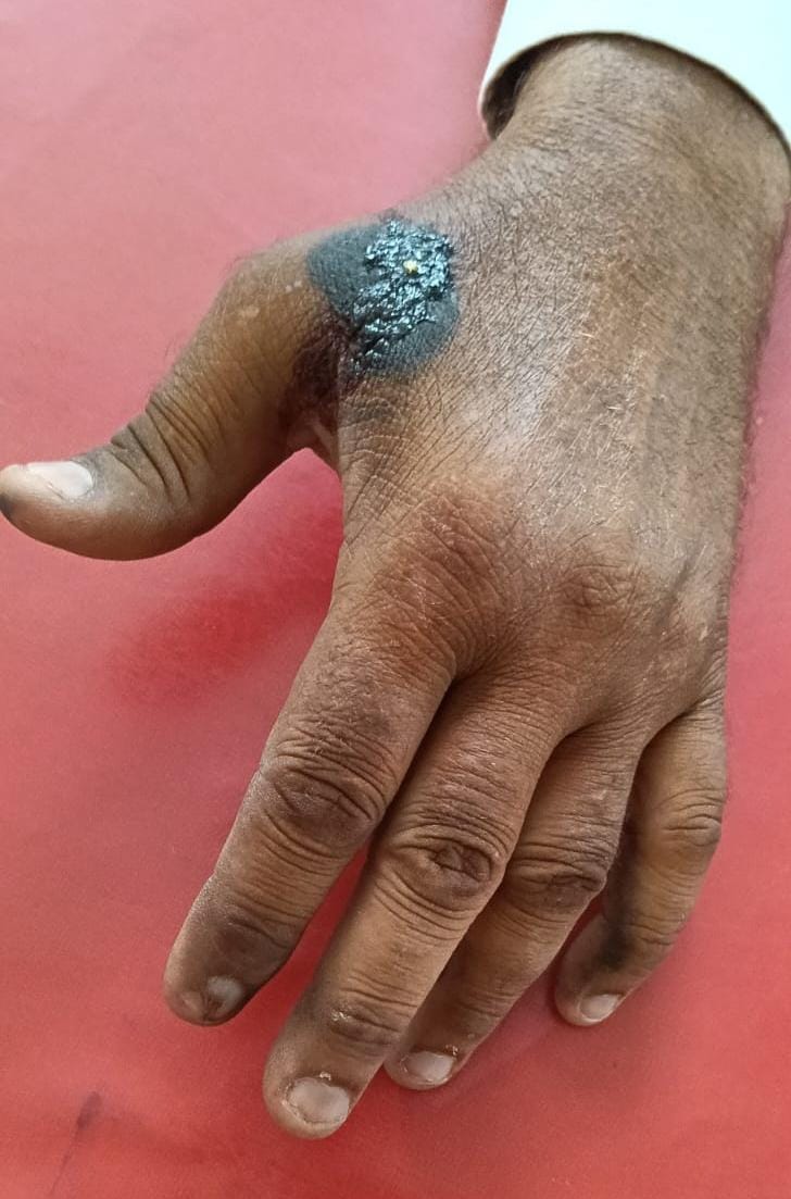 Life-threatening attack on farmer working in the field