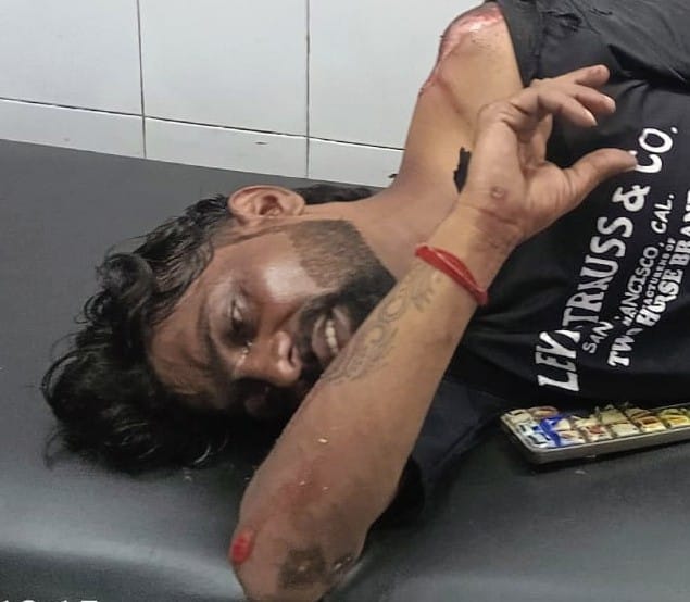 Injured bike rider admitted to CHC.
