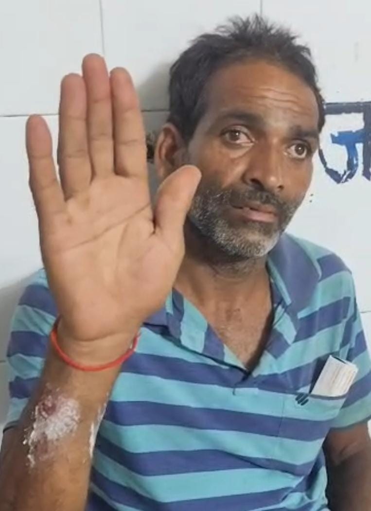 फोटो- 10 घायल राजेंद्र सिंह। संवाद