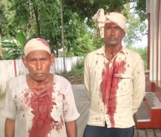 मारपीट के बाद घायल सोहनलाल और कैलाश। संवाद