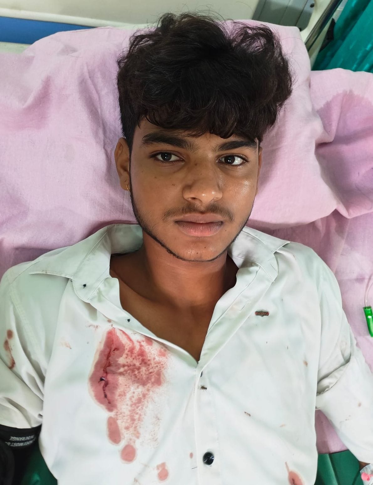 When Surya rushed to save his elder brother, Bhavishya also sustained injuries in the name of friendship.