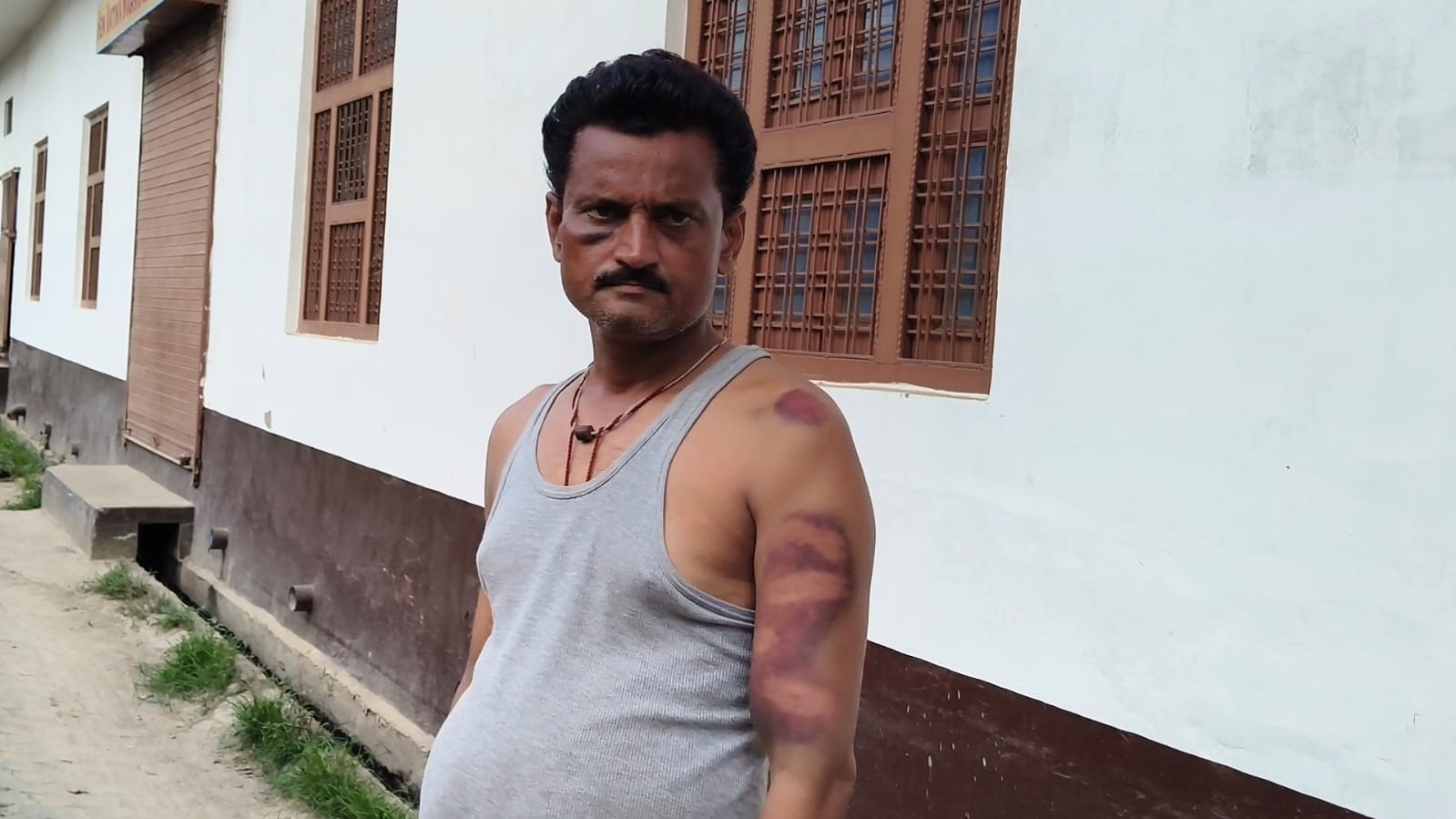 मारपीट का शिकार घायल युवक। संवाद