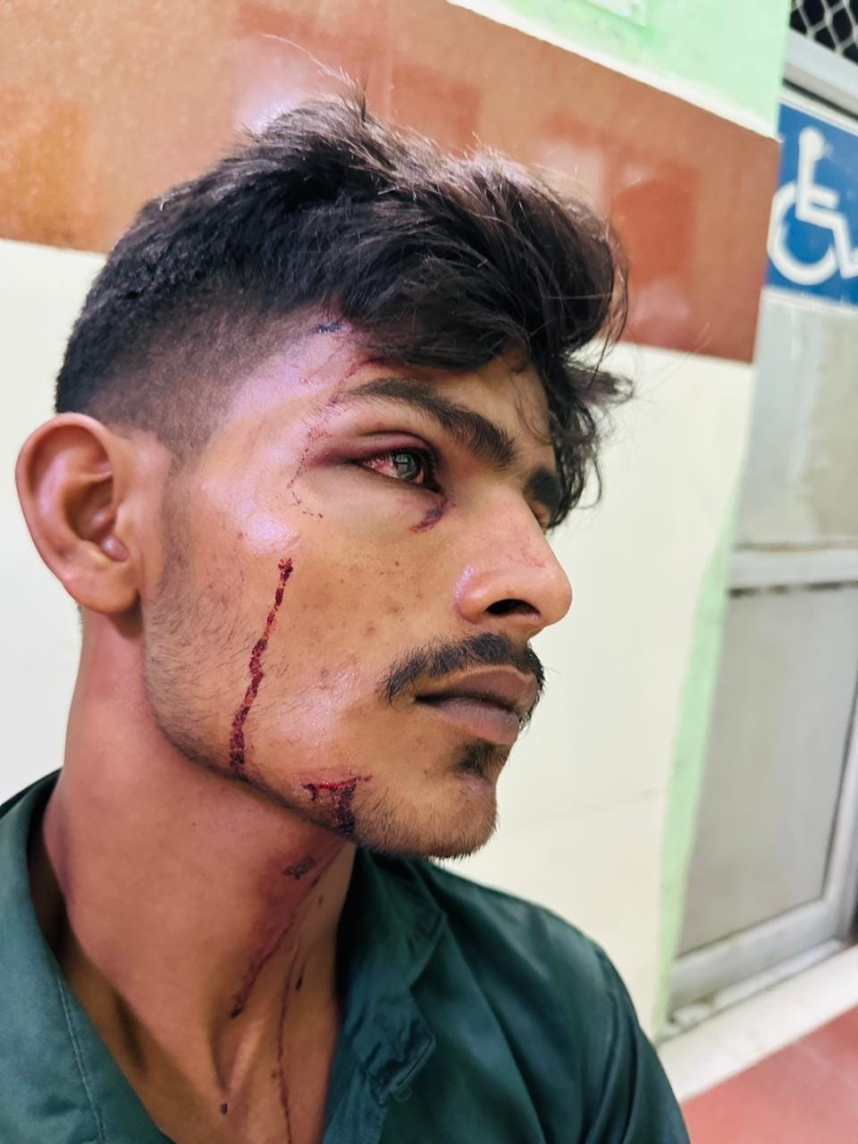 Lucknow News: रंगदारी न देने पर ठेकेदार, पिता व मजदूरों पर हमला