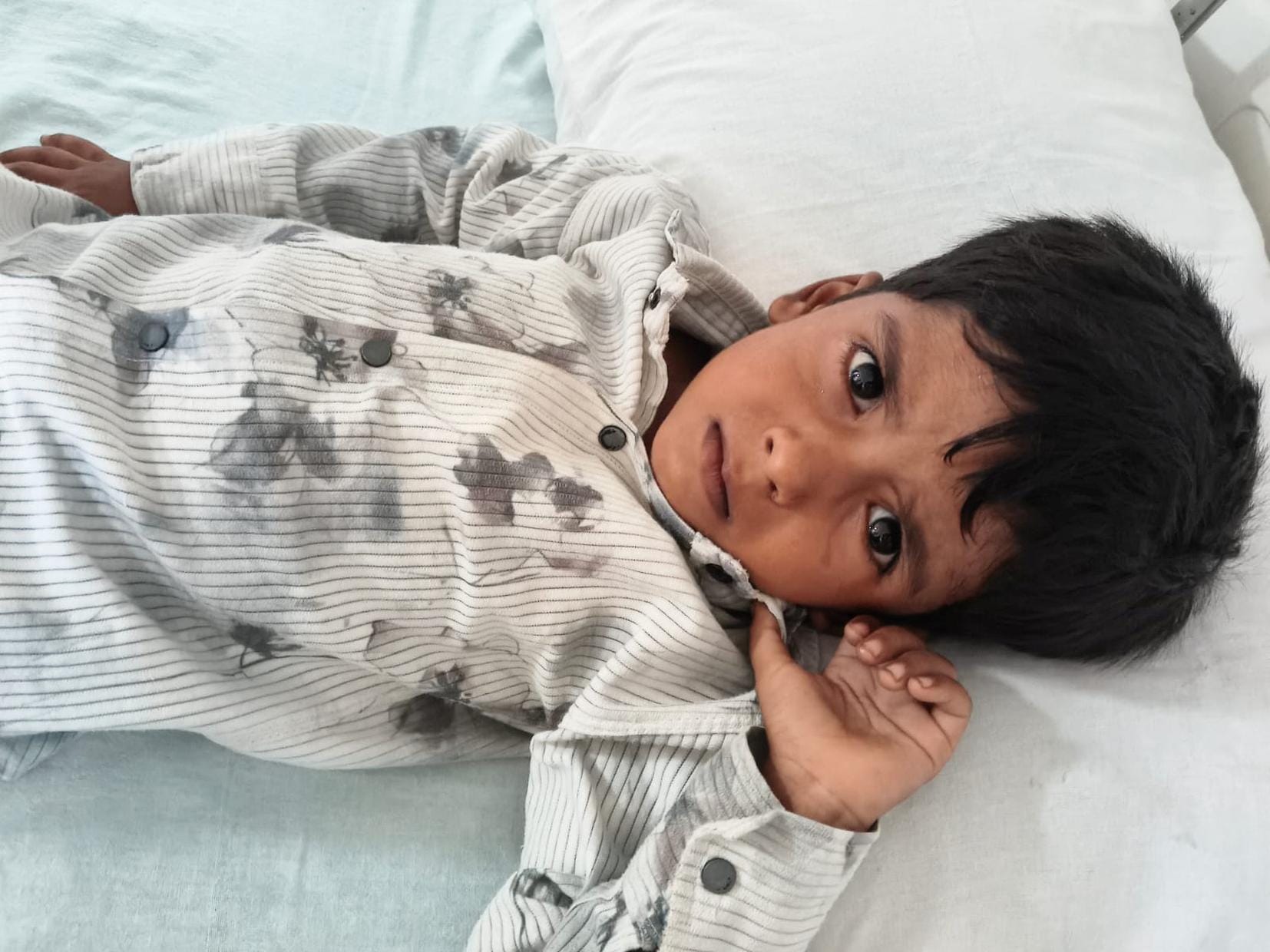 कुत्ते के हमले में घायल बच्चे।