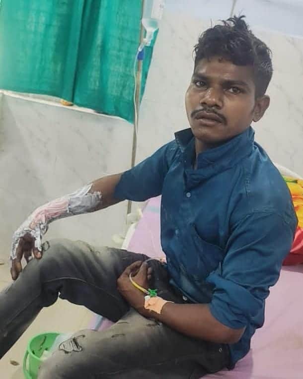 Korba News: Man Pours Petrol on Friend, Sets Him on Fire After Dispute Over Wife