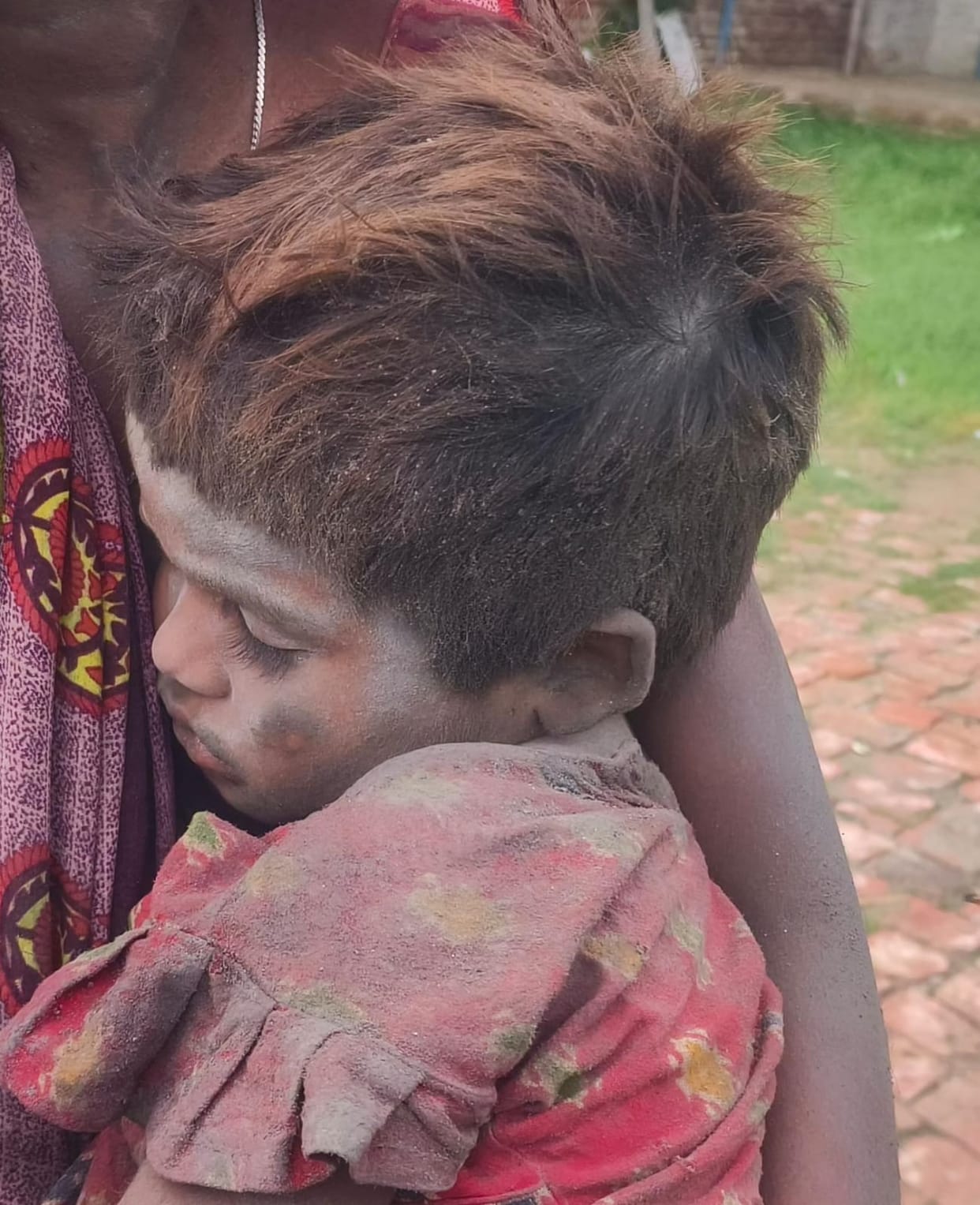 Innocent child gets burnt due to electric shock
