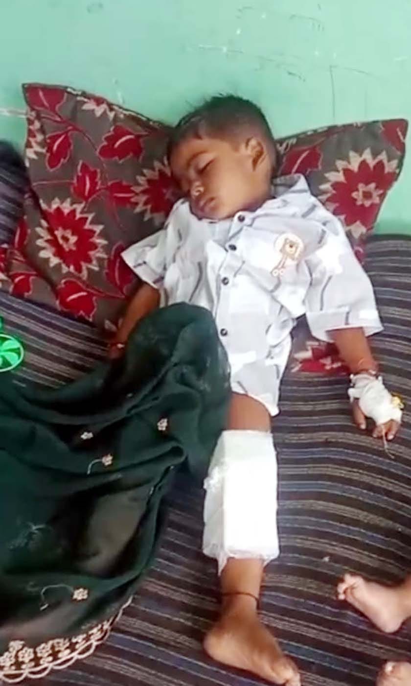 Jackal enters house and attacks three-year-old child; panic in the village.