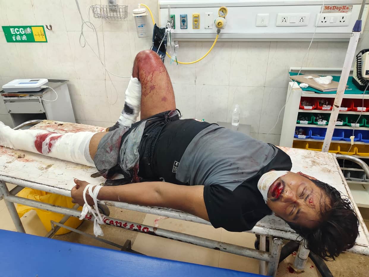 Husband jumps in front of truck after quarrel with wife, condition critical