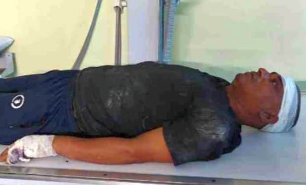 A wild boar attacked a merchant on his way to his shop, leaving him seriously injured.