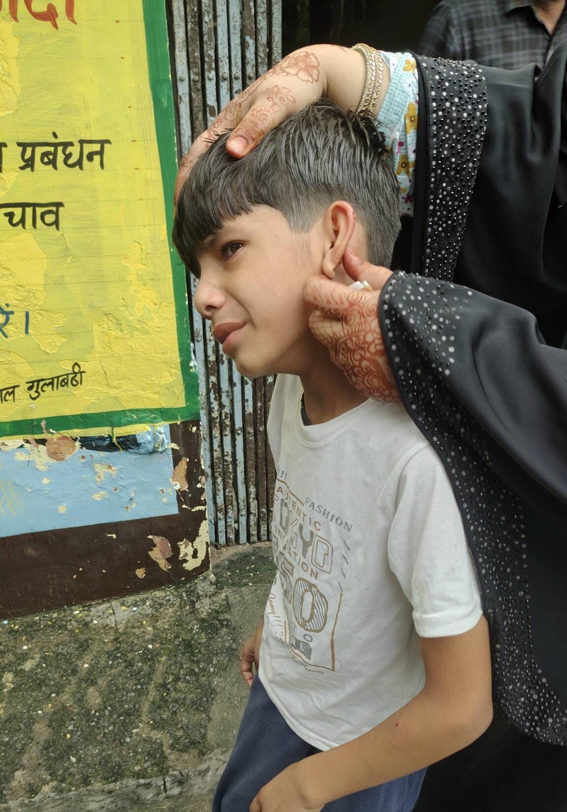 गुलावठी सीएचसी में बंदर काटने का निशान दिखाती इबादुर की मां। संवाद