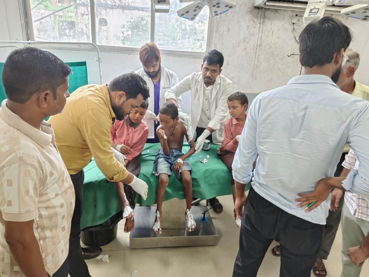 Siddharthnagar News: Six Class 3 students scalded by spilling hot mid-day meal dal