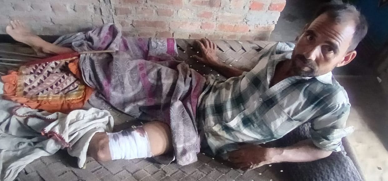 A wild boar injured a farmer working in the field.