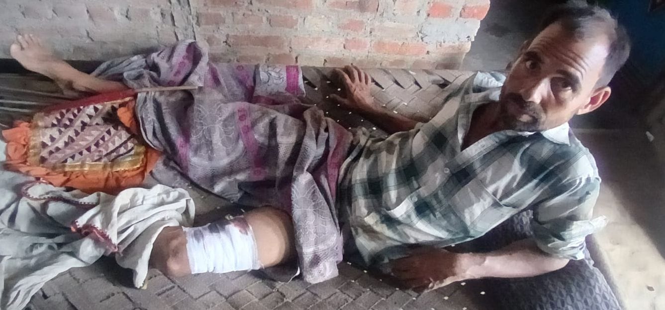 सुअर के हमले में घायल रामकिशोर। संवाद