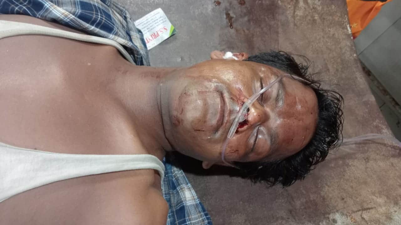जिला अस्पताल की इमरजेंसी में घायल का होता इलाज। संवाद