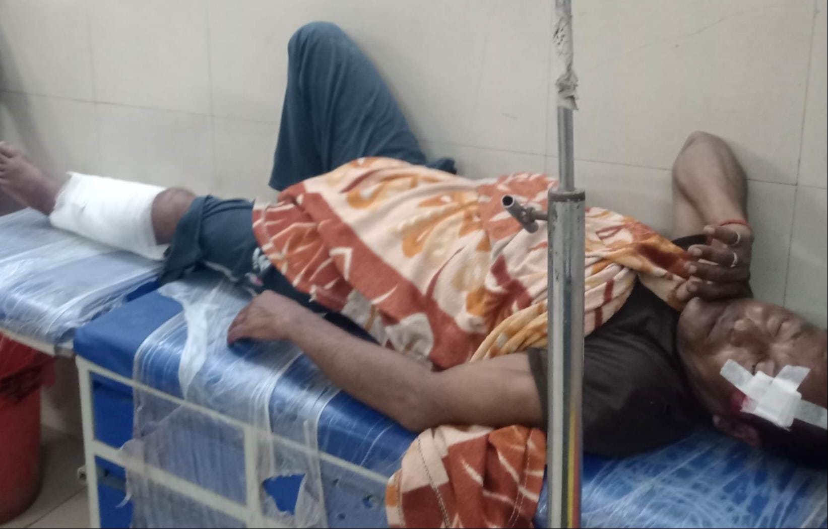 निशानगाड़ा रेंज में गश्त के दौरान पेड़ की डाल गिरने से घायल वनकर्मी।