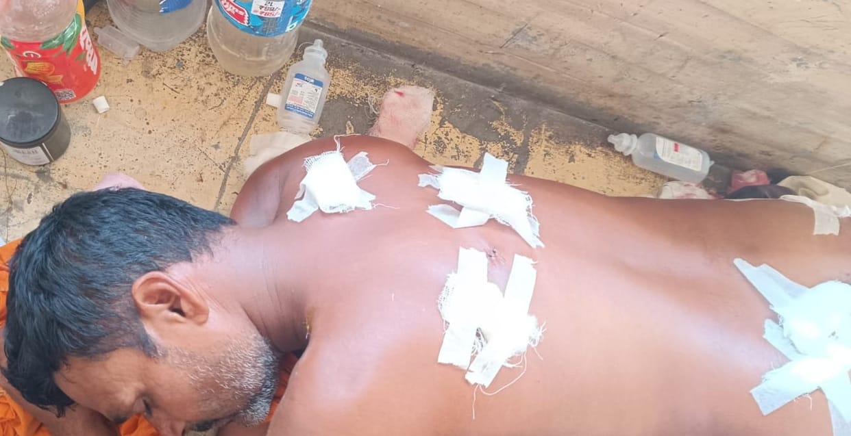 Lured under the pretext of making sweets, then attacked and injured with a knife on the street.