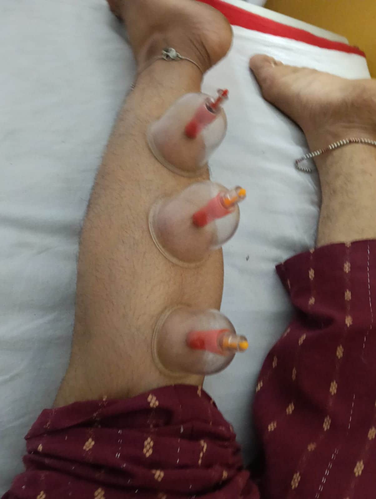 Marma Therapy and Cupping Therapy have become the top choice for people.