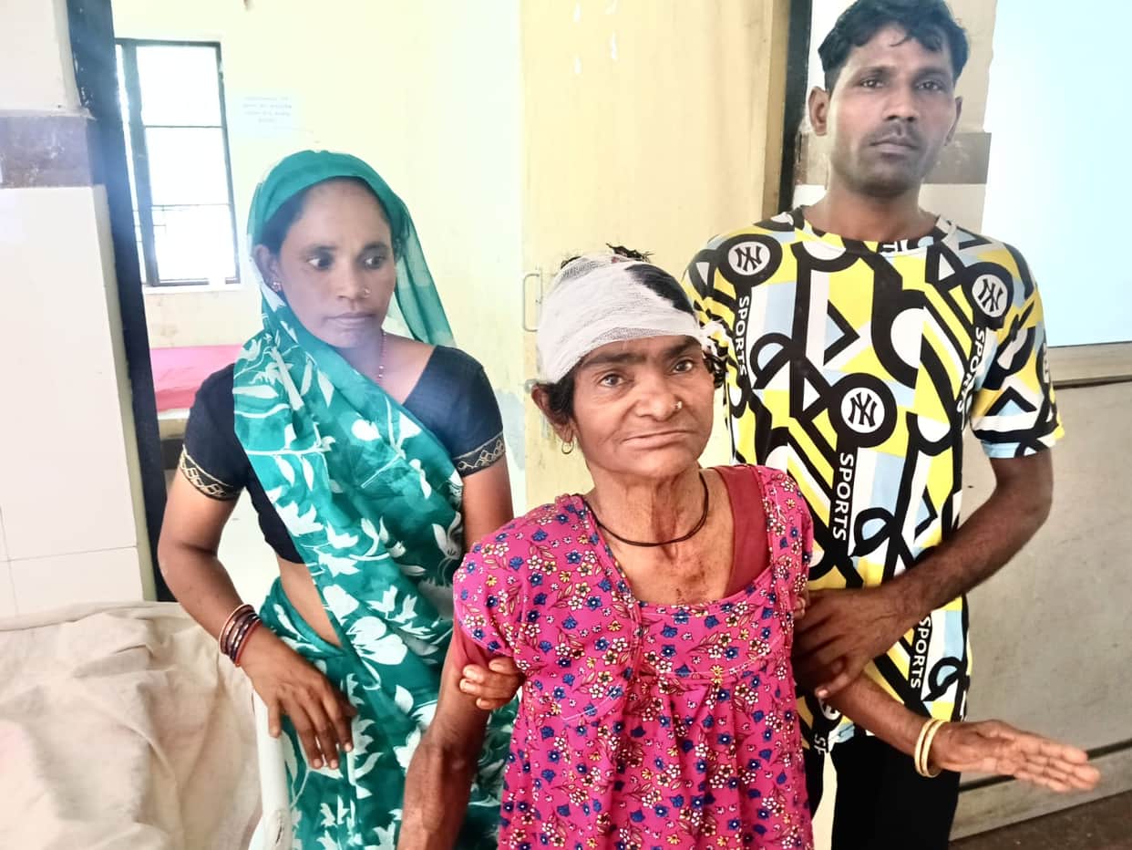 Elderly woman and girl injured in monkey attack