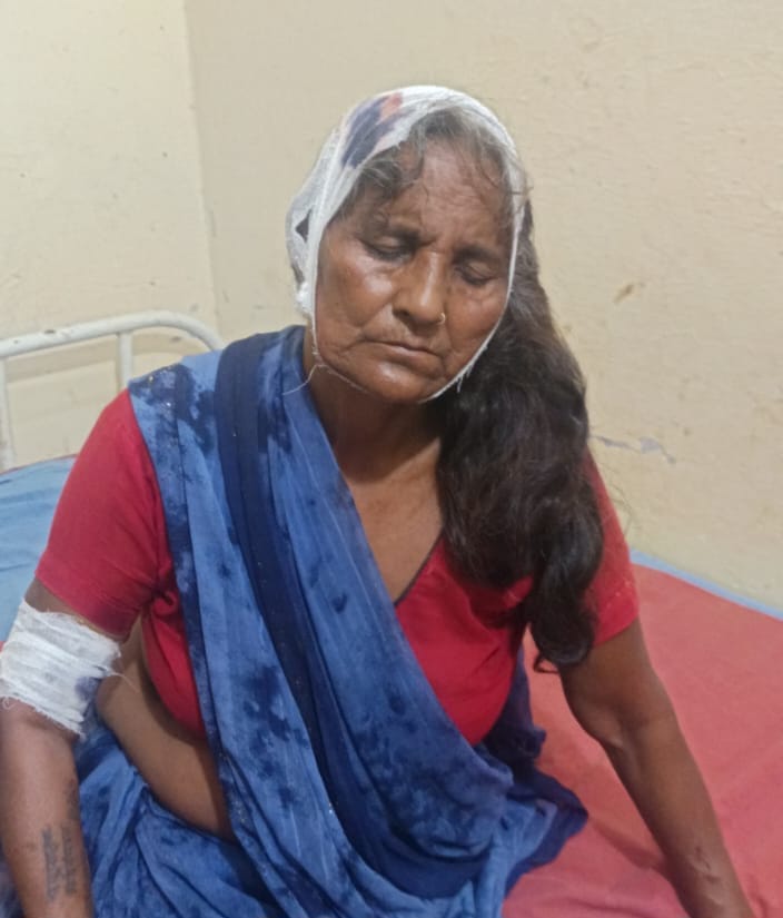  घायल श्रीदेवी