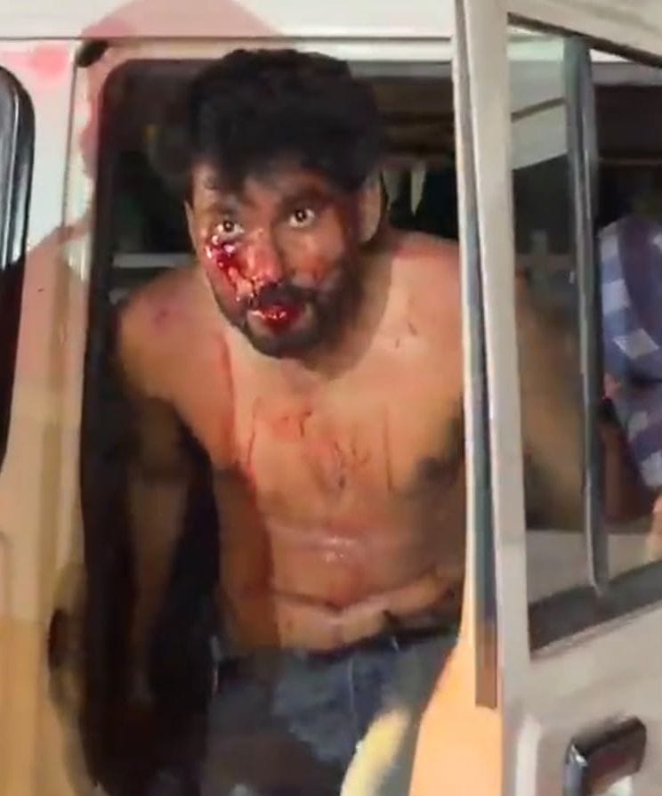 Siddharthnagar News: Two groups clash in Azad Nagar; five injured, FIR registered against 14