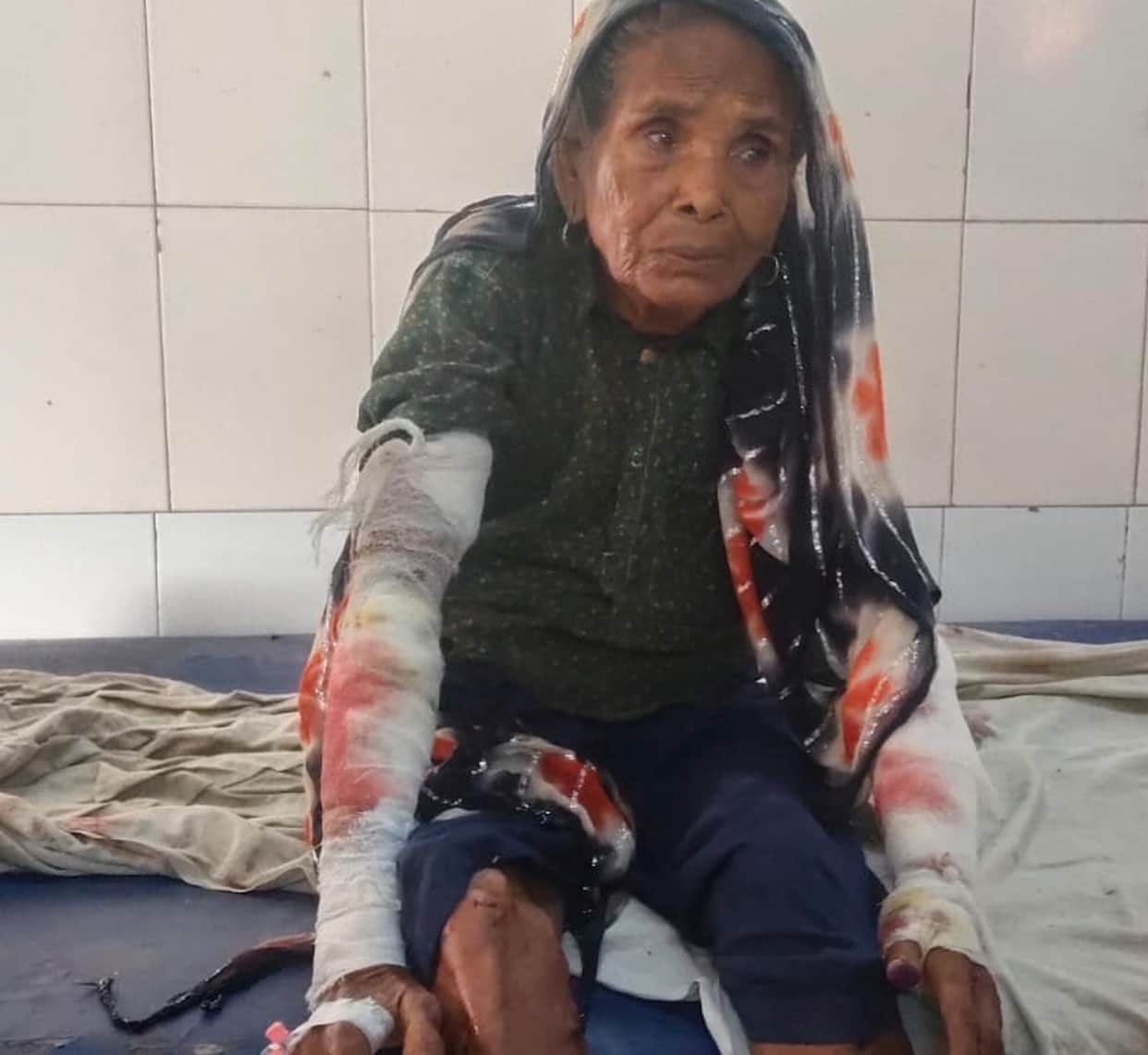 Leopard attacks elderly woman sleeping in courtyard; mauls both her hands.