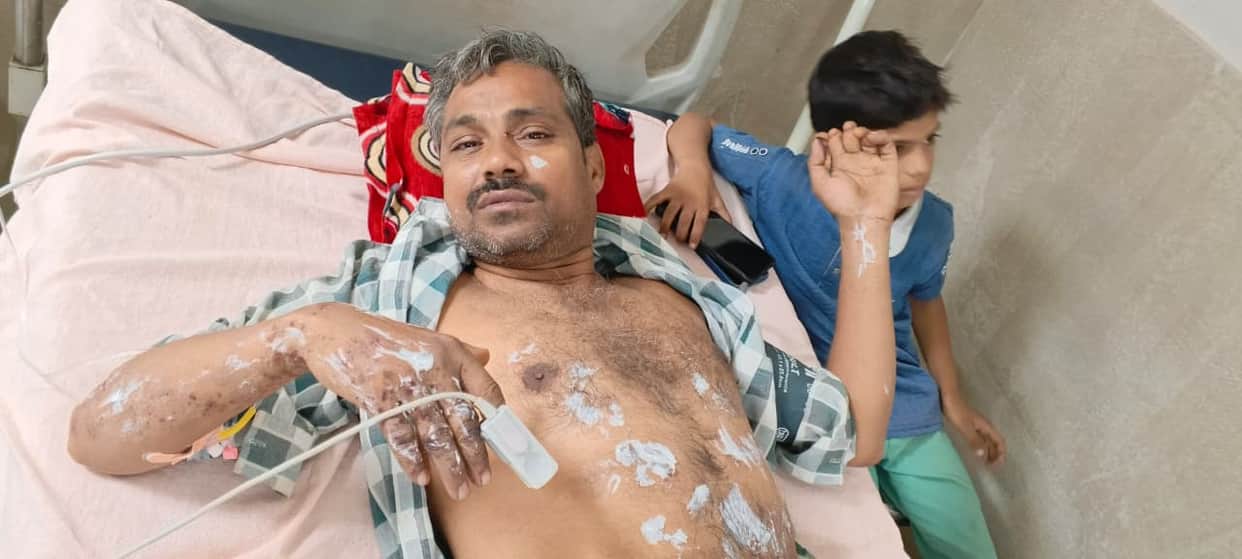 Two people filling balloons with air were seriously injured when a cylinder nozzle burst.