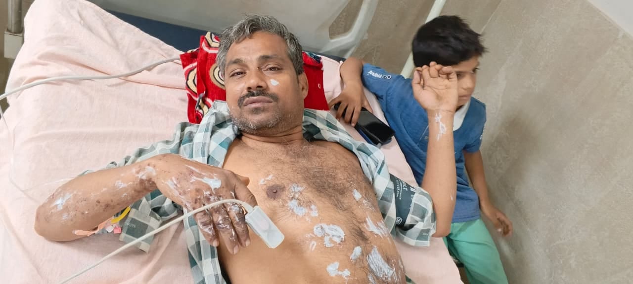 बुलंदशहर सिलिंडर का नोजिल फटने से घायल राजेश जिला चिकित्सालय में भर्ती। संवाद