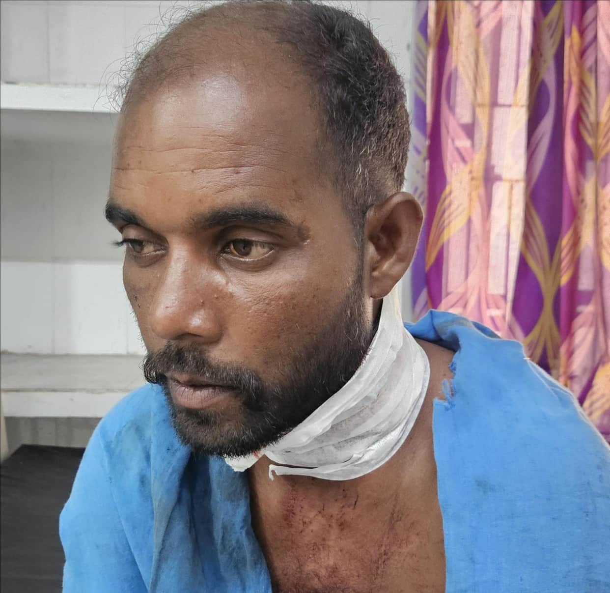 Younger brother attacked with an axe over a land dispute; condition critical