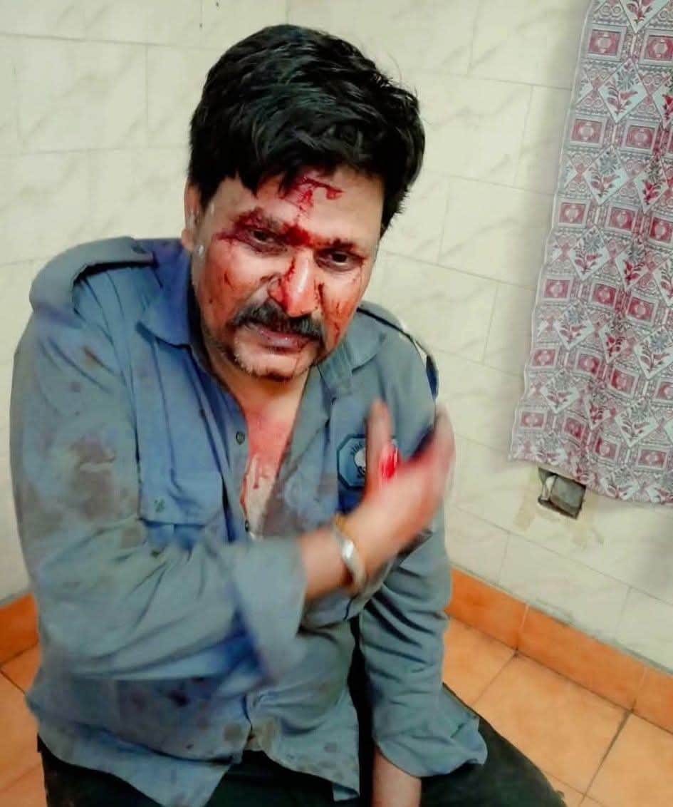 Ex-serviceman guarding coal mine attacked with an axe; scrap dealers flee after looting his gun and mobile phone.