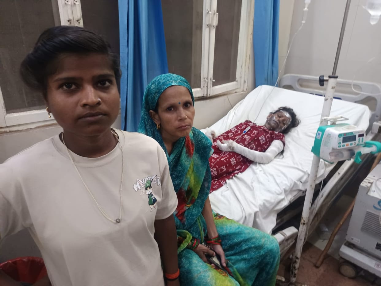 Married woman sets herself on fire after domestic dispute, husband also gets burnt while trying to save her