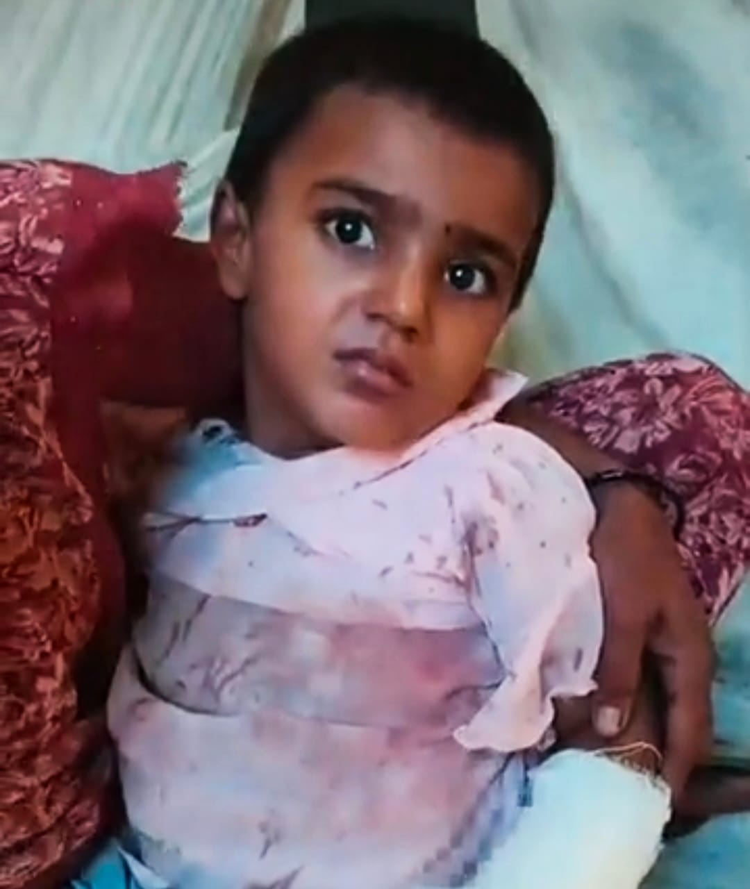 A girl's hand was cut off by a fodder machine.