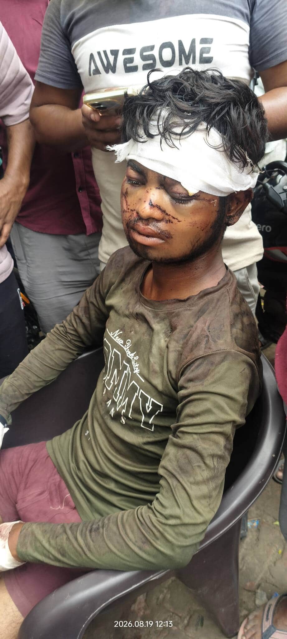 Bela started crying when the body arrived, the family insisted on compensation
