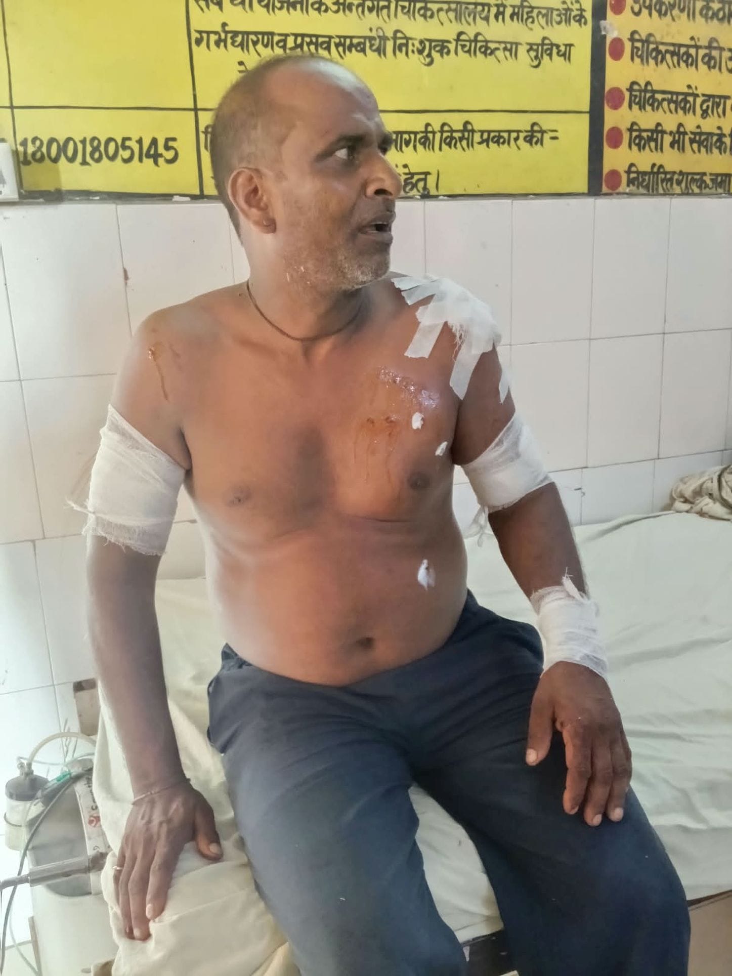 कतर्नियाघाट के सहजरामपुरवा में तेंदुए के हमले में घायल जगदीश।