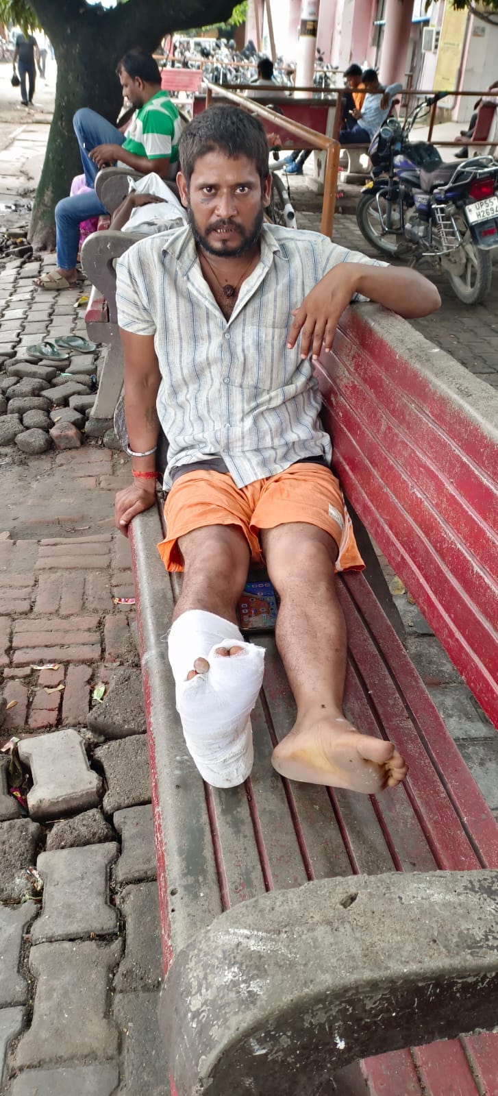पुलिस की पिटाई से घायल पीड़ित अखिलेश पांडेय। संवाद