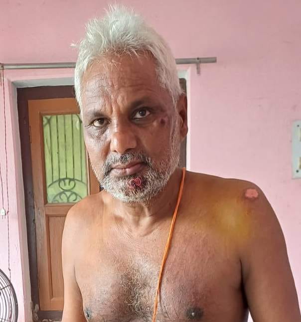 Elderly man injured in bull attack