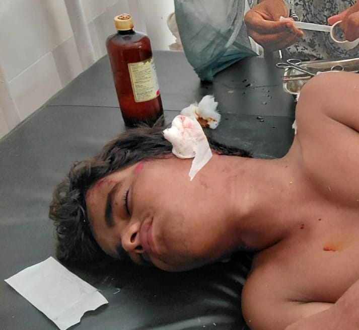 बलरामपुर के मुख्य बौद्ध परिपथ पर लठावर मोड़ के पास पलटी बस।