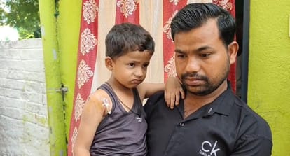 आवारा कुत्ते का हमला