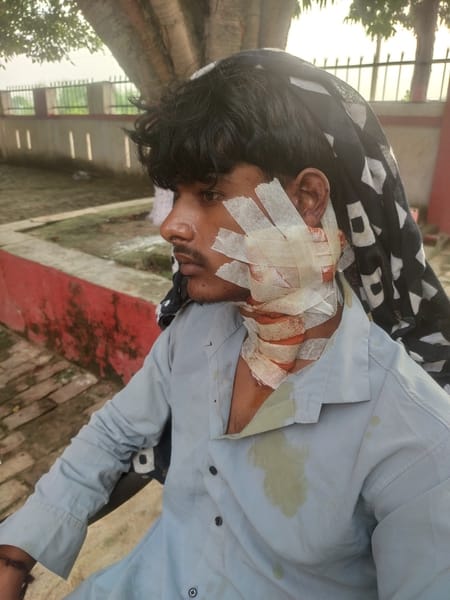 फरसे के हमले से घायल मोहित। संवाद