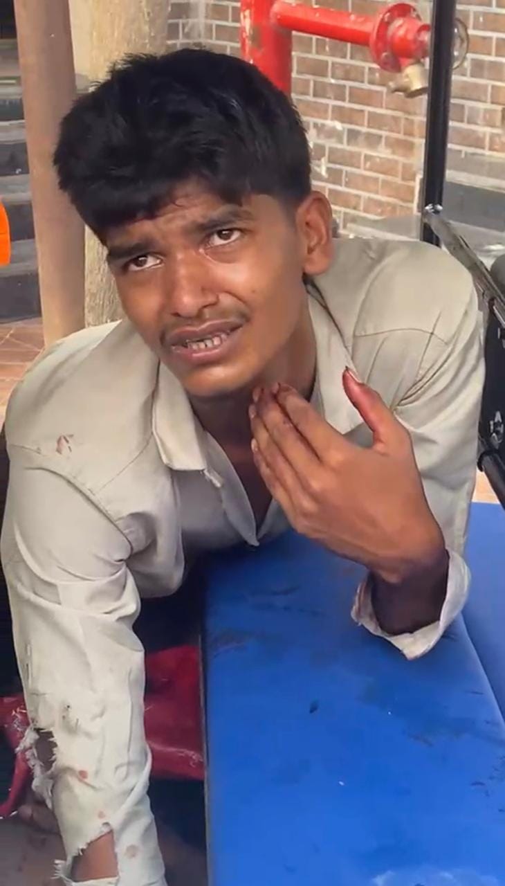 मदद के लिए गुहार लगाता घायल युवक का साथी।