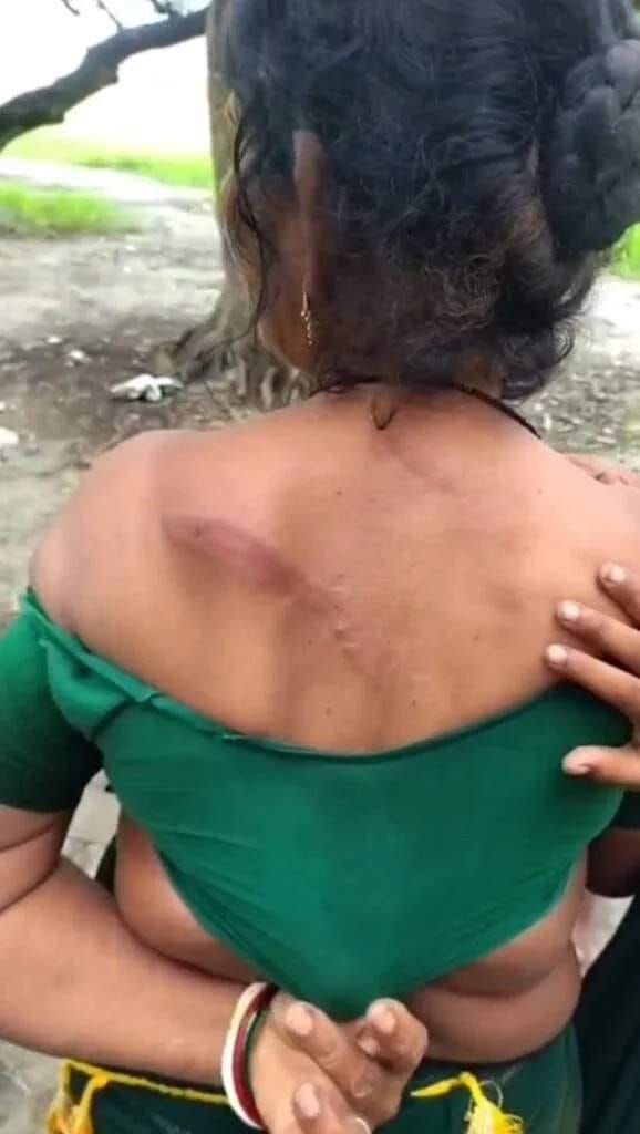 सकलडीहा में पिटाई से घायल महिला। स्रोत:-जागरूक पाठक