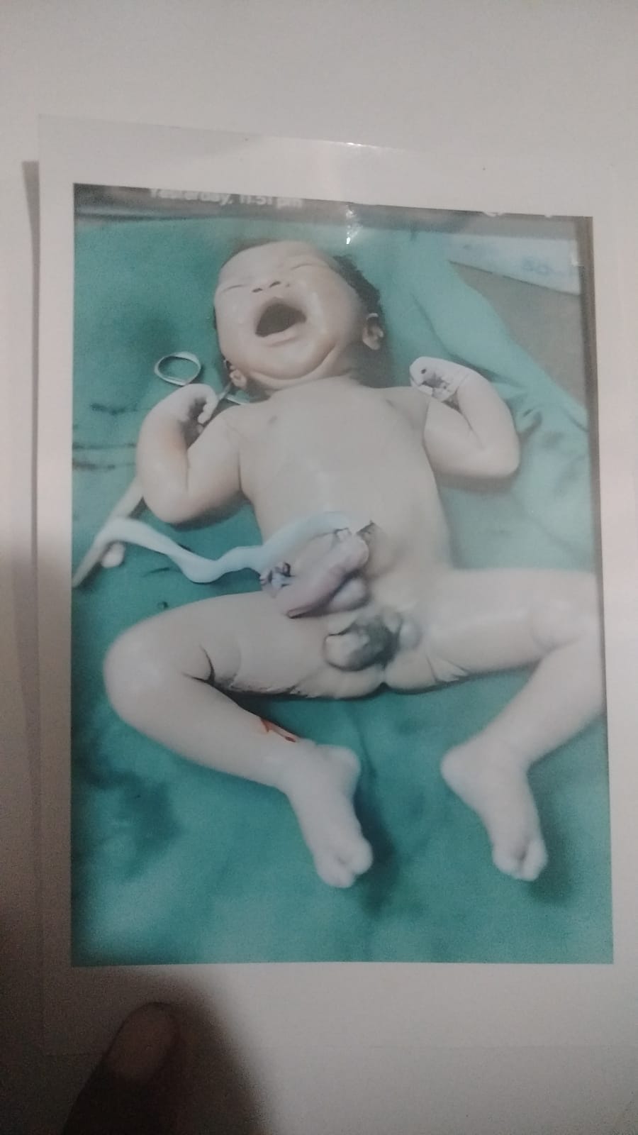 Ultrasound didn't reveal the baby's abnormalities, newborn dies