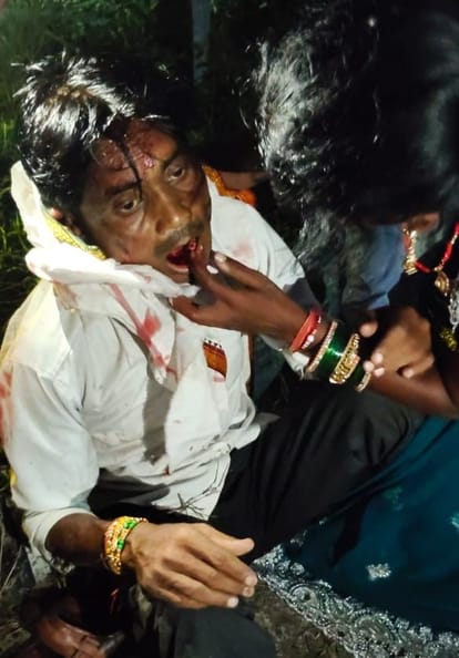  किसान पथ पर घायल युवक