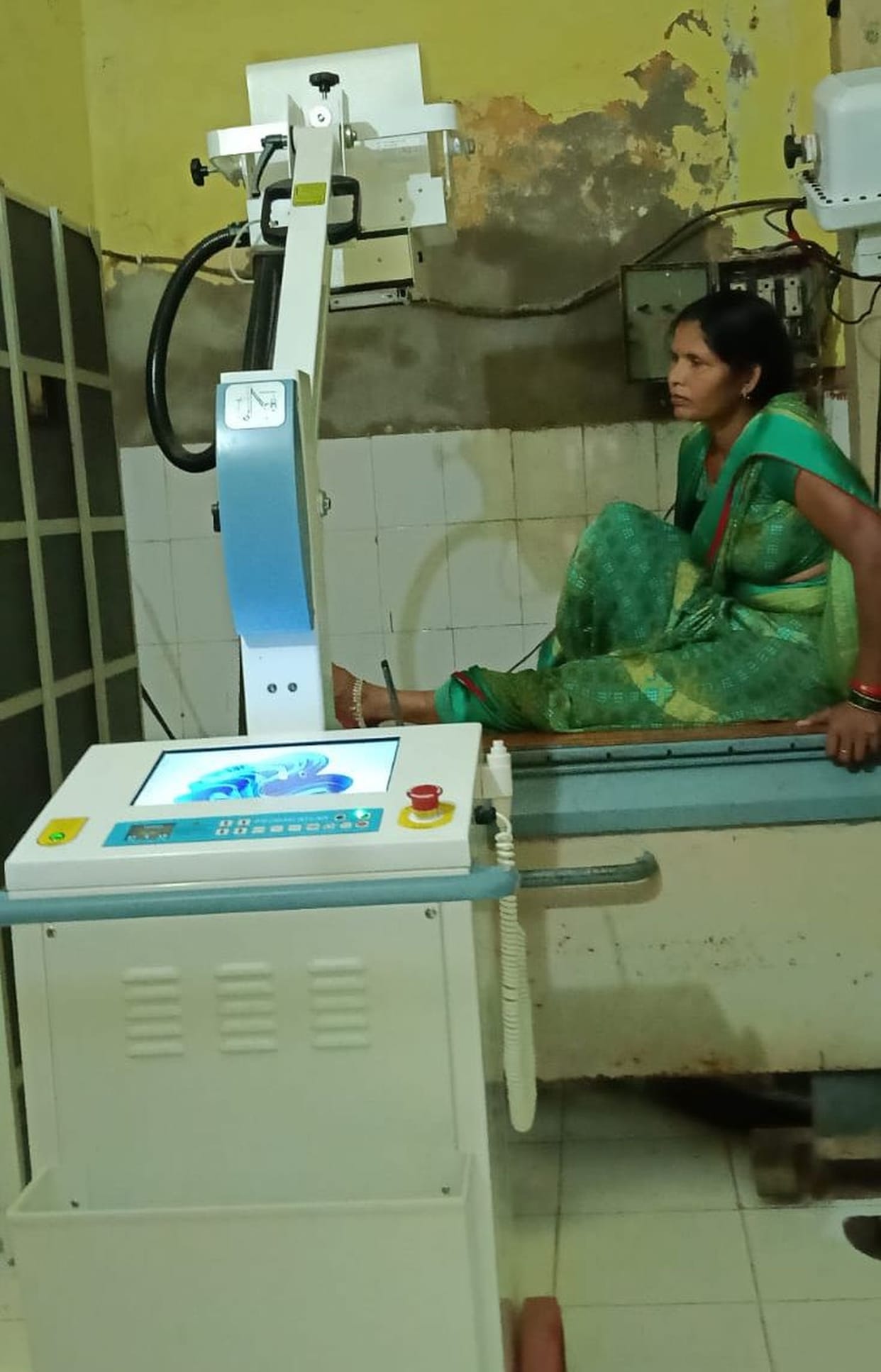 Digital X-ray machine installed at the CHC