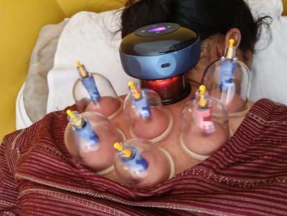 आयुर्वेदिक अस्पताल लंबलू में कपिंग थेरेपी का लाभ लेती मरीज। स्रोत : संस्थान