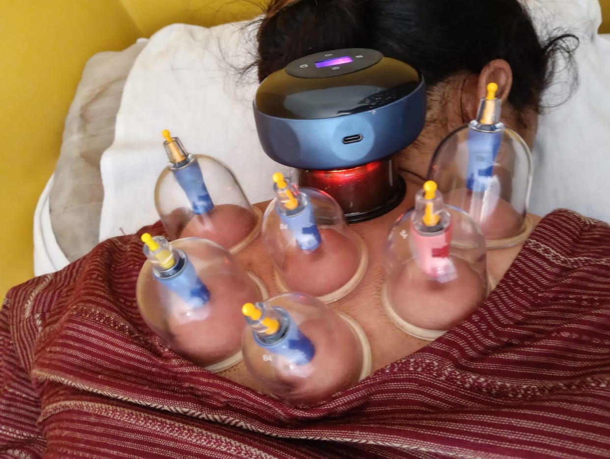 Growing interest in Panchakarma and cupping therapy at the Ayurvedic Hospital, Lamblu.