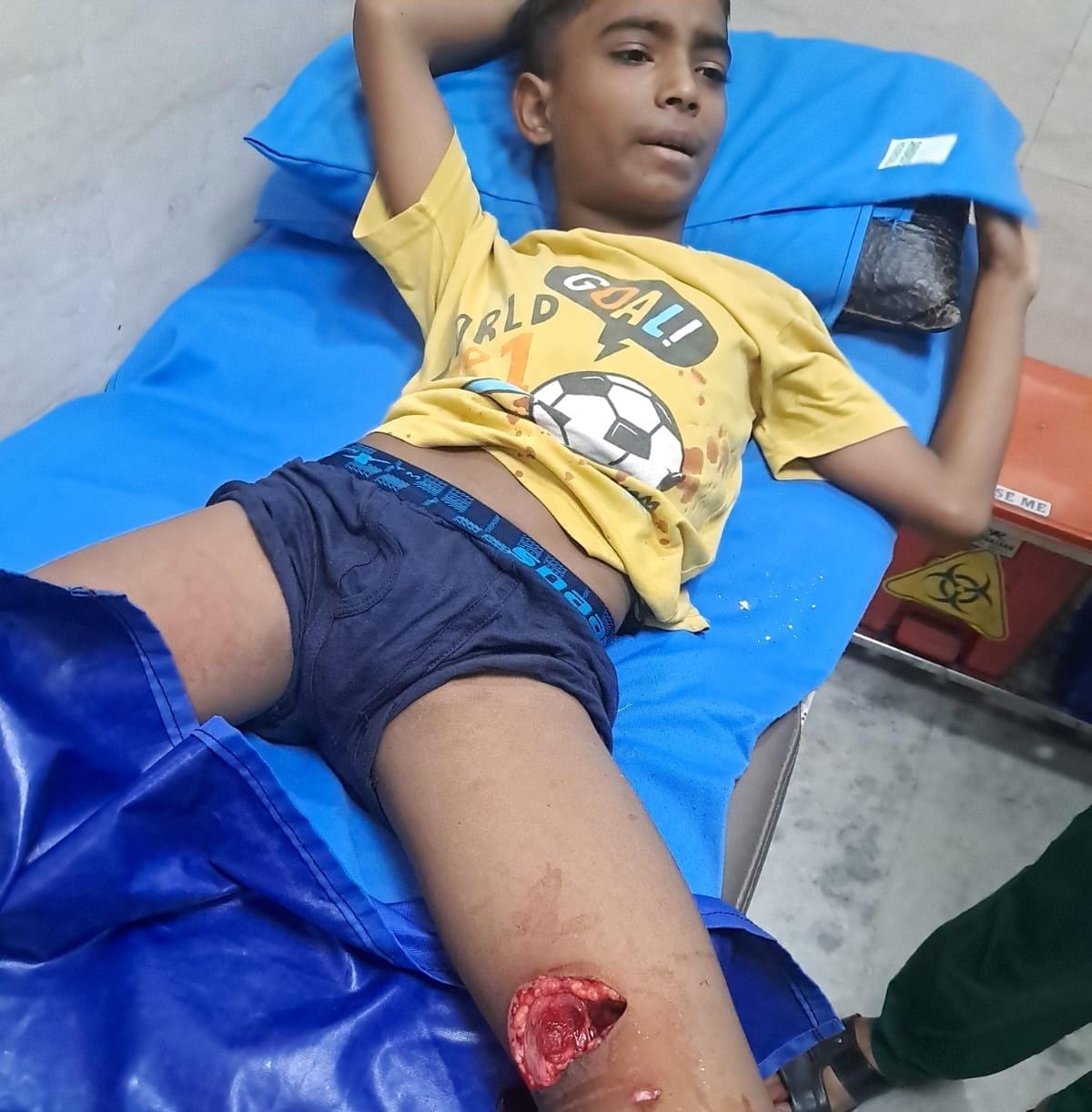 Child hospitalized after monkey attack