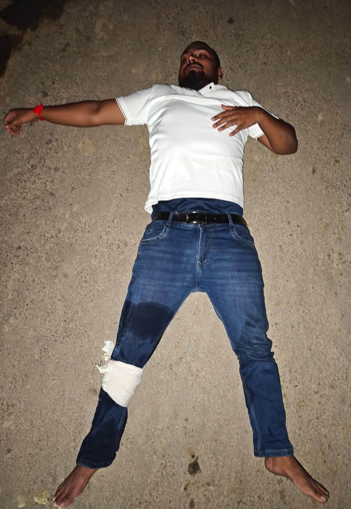 Two miscreants shot in leg in encounter, three arrested