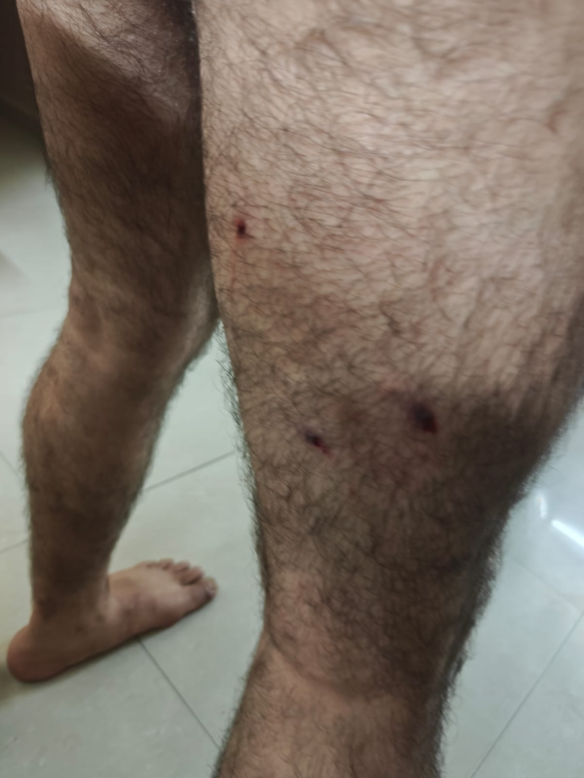 Resident injured in dog attack at Prateek Wisteria