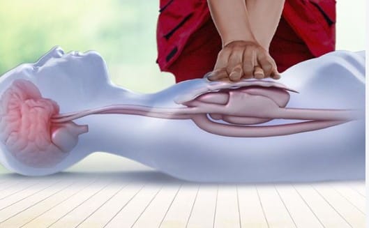 If a person's heartbeat stops, their life can be saved by administering CPR.